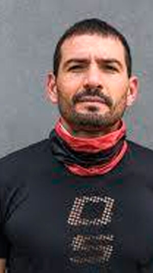 CUELLO X EXTREMO R